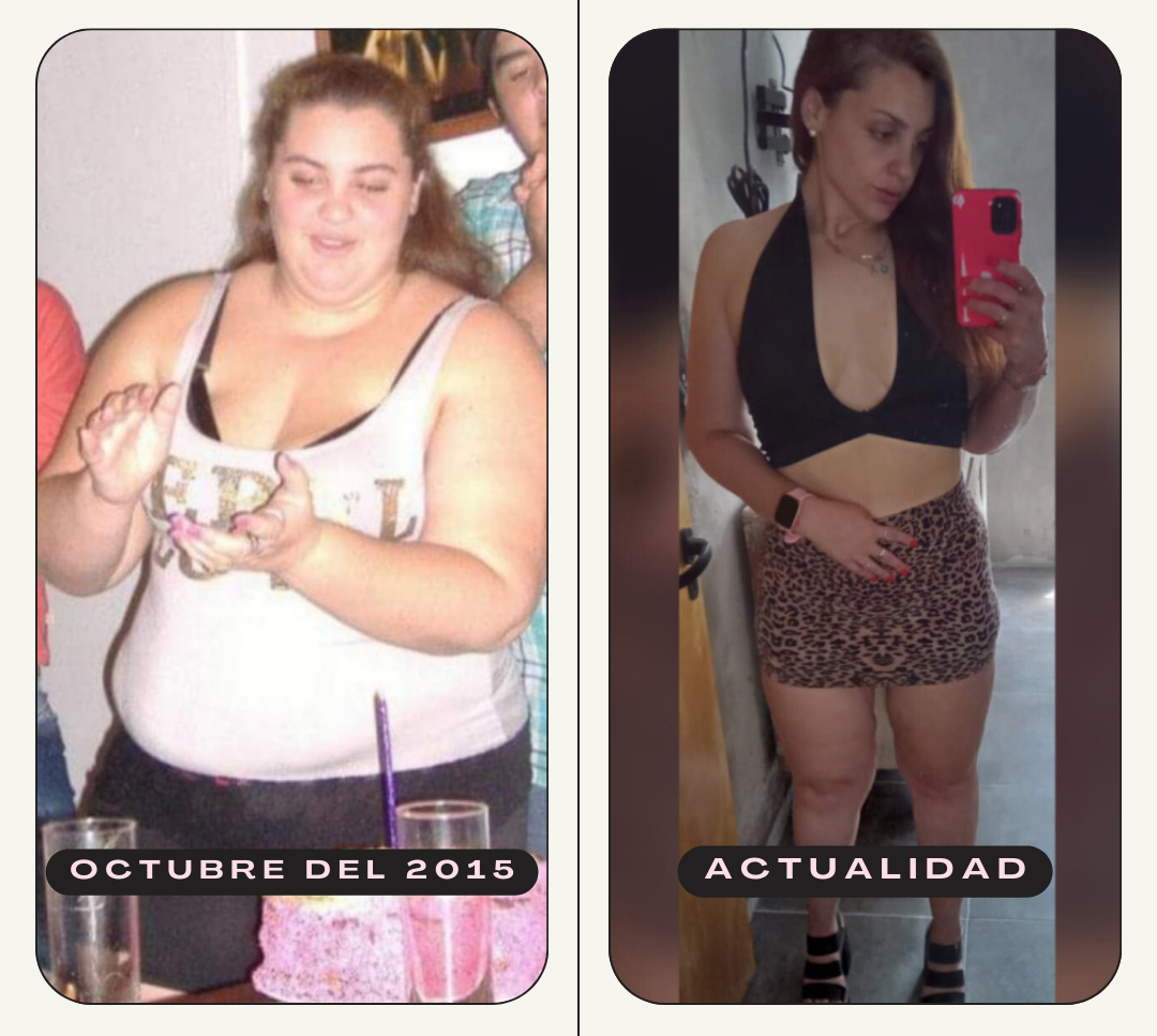 Fotos del antes y después de una paciente