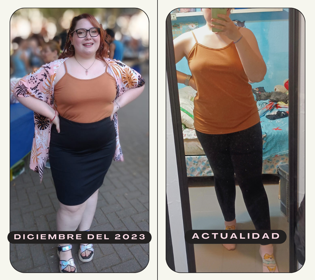 Fotos del antes y después de una paciente