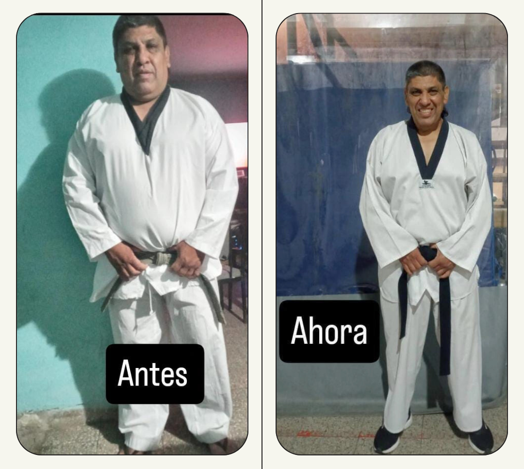 Fotos del antes y después de un paciente